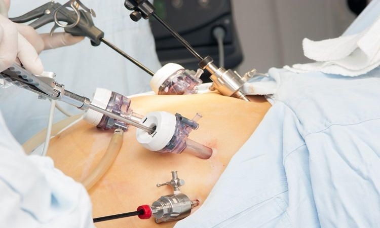 Best Gynaecological Surgeries in Gurugram
