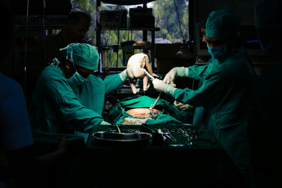 C-section delivery being performed by a medical team in an operating room